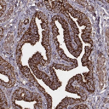 Monoclonal Anti-TUFM antibody produced in mouse，100UL，AMAB90965-100UL，Sigma