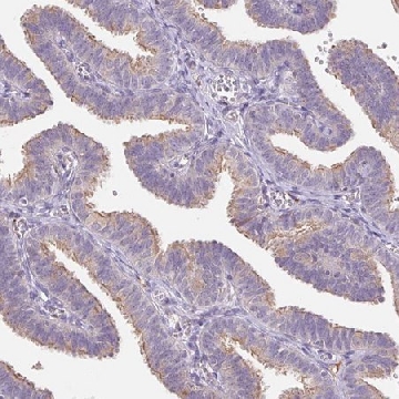 Anti-EMC6 antibody produced in rabbit，100UL，HPA062681-100UL，Sigma