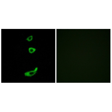 Anti-CRHR1 antibody produced in rabbit，100UG，SAB4500465-100UG，Sigma