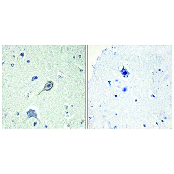 Anti-CNR1 antibody produced in rabbit，100UG，SAB4500345-100UG，Sigma
