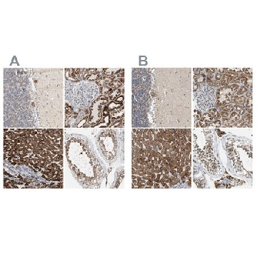 Anti-ACAT1 antibody produced in rabbit，100UL，HPA004428-100UL，Sigma