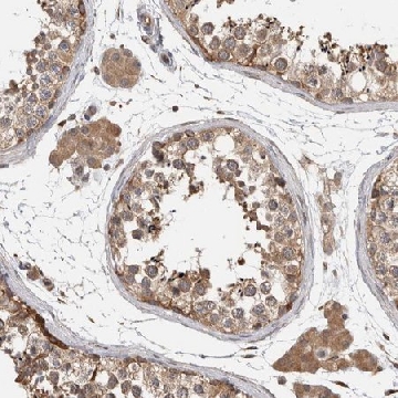 Anti-PARP6 antibody produced in rabbit，100UL，HPA026991-100UL，Sigma