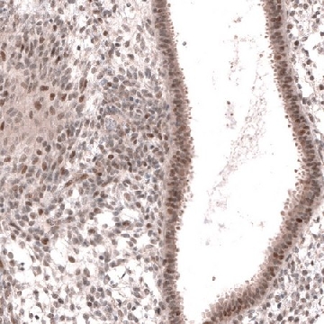 Anti-MGA antibody produced in rabbit，100UL，HPA042278-100UL，Sigma