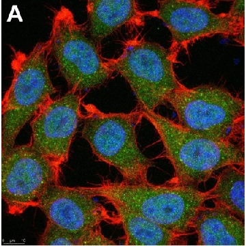 Anti-p16 Antibody, clone D25 ZooMAb® Mouse Monoclonal，4X25UL，ZMS1072-4X25UL，Sigma