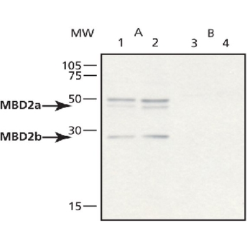 Anti-MBD2a,b (RA-18) antibody produced in rabbit，200UL，M7318-200UL，Sigma