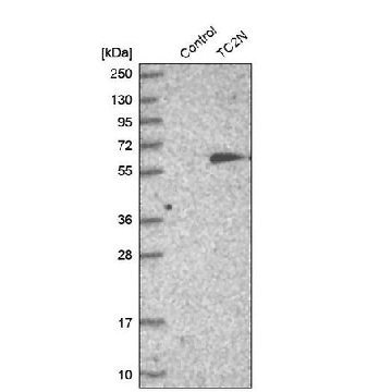 Anti-TC2N antibody produced in rabbit，100UL，HPA027549-100UL，Sigma