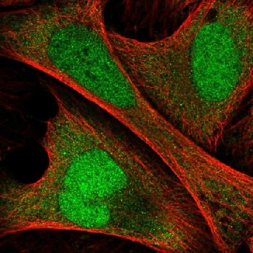 Anti-ANKRD36C antibody produced in rabbit，100UL，HPA051757-100UL，Sigma