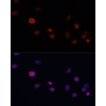 Anti-CDKN1A antibody produced in rabbit，100UL，SAB5700742-100UL，Sigma