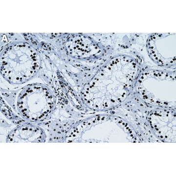 Anti-Ub-Histone H2A-Lys119 Antibody, clone 8B21 ZooMAb® Rabbit Monoclonal，25UL，ZRB1946-25UL，Sigma