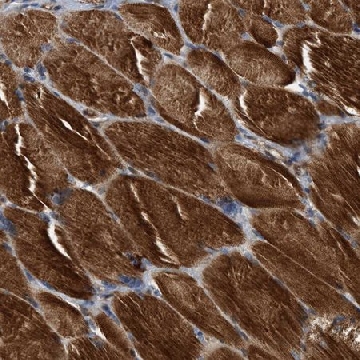 Anti-SLC16A3 antibody produced in rabbit，100UL，HPA021451-100UL，Sigma