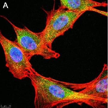 Anti-phospho-IRE-1α (Ser724) Antibody, clone 1M2 ZooMAb® Rabbit Monoclonal，4X25UL，ZRB1072-4X25UL，Sigma