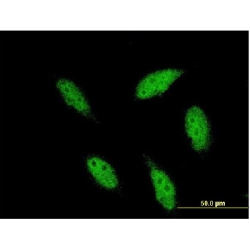 Monoclonal Anti-TBR1 antibody produced in mouse，100UG，WH0010716M1-100UG，Sigma