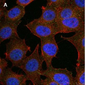 Anti-phospho-Stat1-Tyr701 Antibody, clone 1F23 ZooMAb® Rabbit Monoclonal，4X25UL，ZRB1520-4X25UL，Sigma