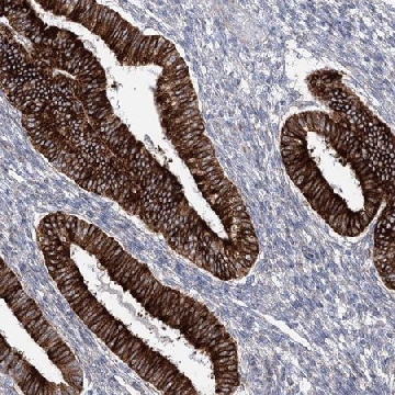 Anti-YTHDC2 antibody produced in rabbit，100UL，HPA037364-100UL，Sigma