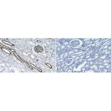 Anti-GSDMC Antibody, clone 2H7 ZooMAb® Rabbit Monoclonal，，ZRB2786-4X25UL，Sigma