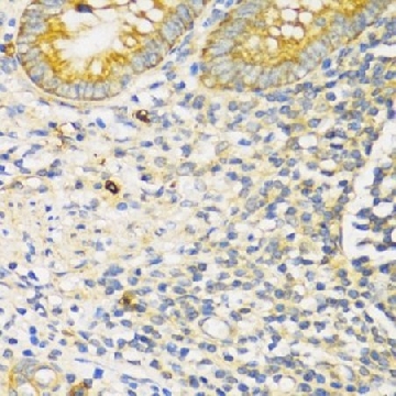 Anti-TGFBR2 antibody produced in rabbit，100UL，SAB5700739-100UL，Sigma