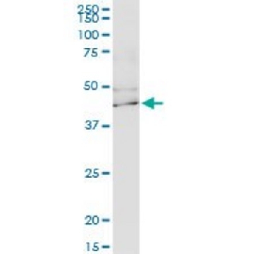 Monoclonal Anti-KCNJ15 antibody produced in mouse，100UG，SAB1404003-100UG，Sigma