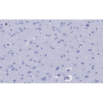 抗-GFAP抗体，克隆2E8，ZooMAb®兔单克隆抗体，25UL，ZRB2383-25UL，Sigma