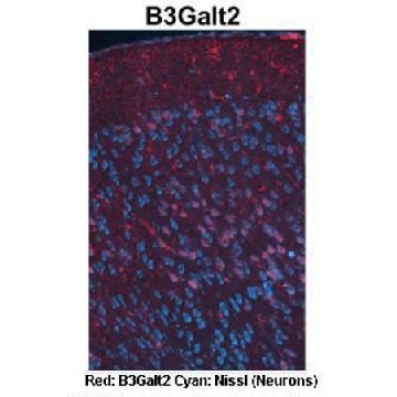 抗-B3GALT2 兔抗，100UL，SAB2108414-100UL，Sigma
