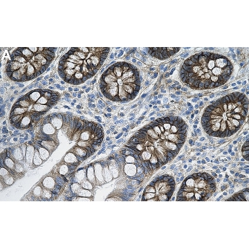 Anti-CD167a/DDR1 Antibody, clone 1D11 ZooMAb® Rabbit Monoclonal，25UL，ZRB2086-25UL，Sigma