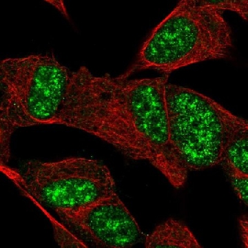 Anti-FAM227B antibody produced in rabbit，100UL，HPA061695-100UL，Sigma