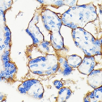 Anti- PD-L1/CD274 antibody produced in rabbit，100UL，SAB5701213-100UL，Sigma