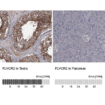 Anti-FLVCR2 antibody produced in rabbit，100UL，HPA037984-100UL，Sigma