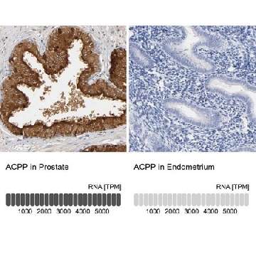 Anti-ACPP antibody produced in rabbit，100UL，HPA004335-100UL，Sigma