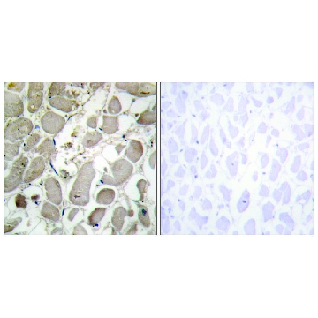 Anti-Collagen V α1 antibody produced in rabbit，100UG，SAB4500384-100UG，Sigma