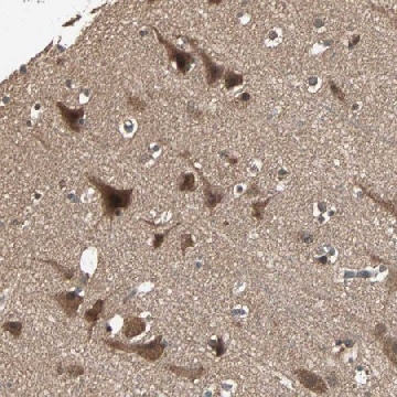 Anti-UBAC1 antibody produced in rabbit，100UL，HPA005651-100UL，Sigma