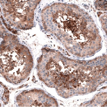 Anti-OSBP2 antibody produced in rabbit，100UL，HPA021514-100UL，Sigma