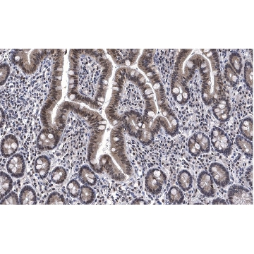 Anti-ATM Antibody, clone 4N19, ZooMAb® Rabbit Monoclonal，25UL，ZRB1376-25UL，Sigma