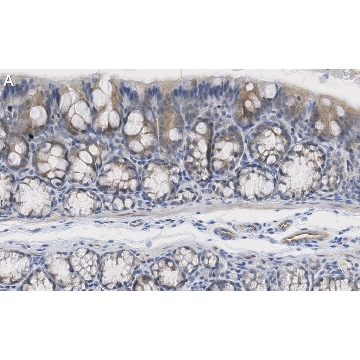 Anti-iNOS (NOSII) Antibody, clone 2G17 ZooMAb® Rabbit Monoclonal，25UL，ZRB1449-25UL，Sigma