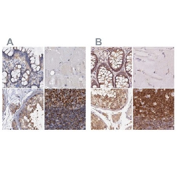Anti-ANKRD13A antibody produced in rabbit，100UL，HPA039488-100UL，Sigma