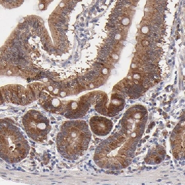 Anti-BAIAP2L2 antibody produced in rabbit，100UL，HPA003043-100UL，Sigma