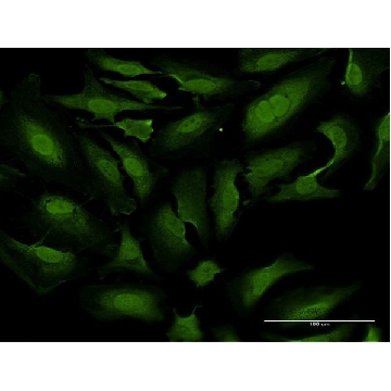 Monoclonal Anti-TKTL1 antibody produced in mouse，100UG，SAB1404574-100UG，Sigma