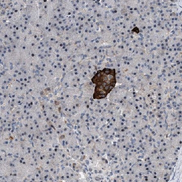 Anti-ZDHHC15 antibody produced in rabbit，100UL，HPA003618-100UL，Sigma