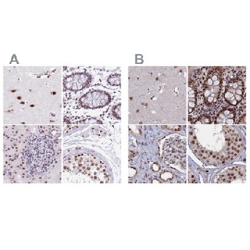 Anti-SF3A2 antibody produced in rabbit，100UL，HPA049439-100UL，Sigma