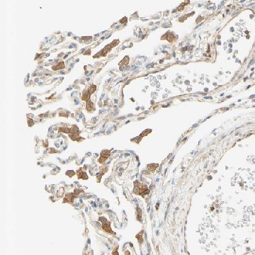 Anti-IKBKG antibody produced in rabbit，100UL，HPA000426-100UL，Sigma