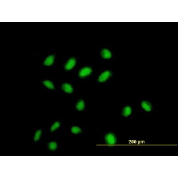 Monoclonal Anti-CDYL antibody produced in mouse，100UG，SAB1402471-100UG，Sigma