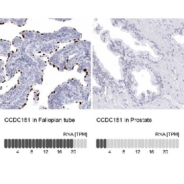 Anti-CCDC181 antibody produced in rabbit，100UL，HPA027189-100UL，Sigma
