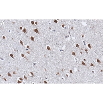 Anti-NOVA2 Antibody, clone 2J16 ZooMAb® Rabbit Monoclonal，25UL，ZRB1742-25UL，Sigma