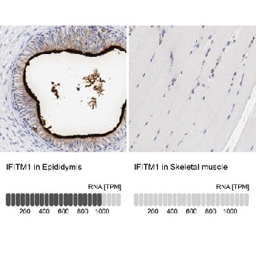 Anti-IFITM1 antibody produced in rabbit，100UL，HPA004810-100UL，Sigma