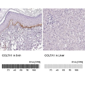 Anti-COL7A1 antibody produced in rabbit，100UL，HPA042420-100UL，Sigma
