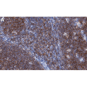 Anti-CD20 Antibody, clone 1E10 ZooMAb® Rabbit Monoclonal，4X25UL，ZRB1844-4X25UL，Sigma