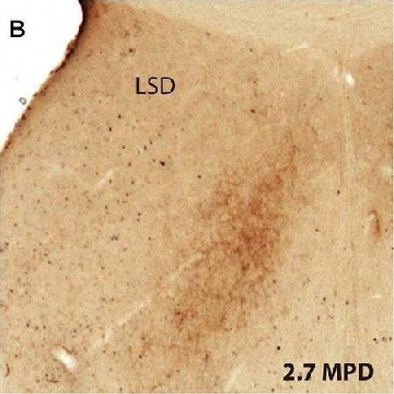 单克隆抗酪氨酸羟化酶 小鼠抗，100UL，T2928-100UL，Sigma