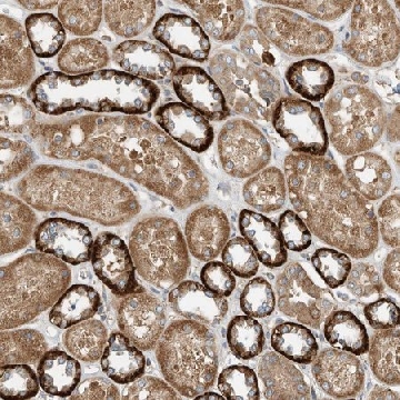 Anti-CPAMD8 antibody produced in rabbit，100UL，HPA031328-100UL，Sigma