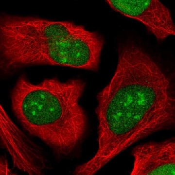 Anti-ZZZ3 antibody produced in rabbit，100UL，HPA054913-100UL，Sigma
