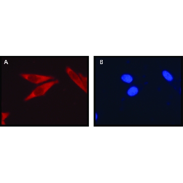 Anti-Ribosomal Protein L26 (N-terminal) 兔抗，200UL，R0655-200UL，Sigma
