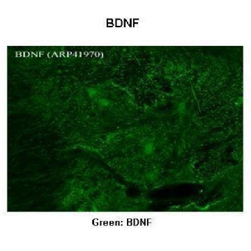 抗  BDNF 兔抗，100UL，SAB2108004-100UL，Sigma